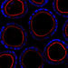 Epithelial cells in basement membrane cultures can organize to form cysts, the building blocks of epithelial glandular tissues. Cysts comprise of a spherical monolayer of cells that surround a hollow lumen. Nuclei: Blue, Actin: Red.