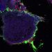 Exfoliation of a bladder cell (blue) covered with fibrin(ogen) (green) and E. faecalis (red)